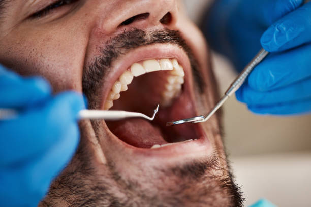 Best Emergency Broken Tooth Repair in Dixon, KY