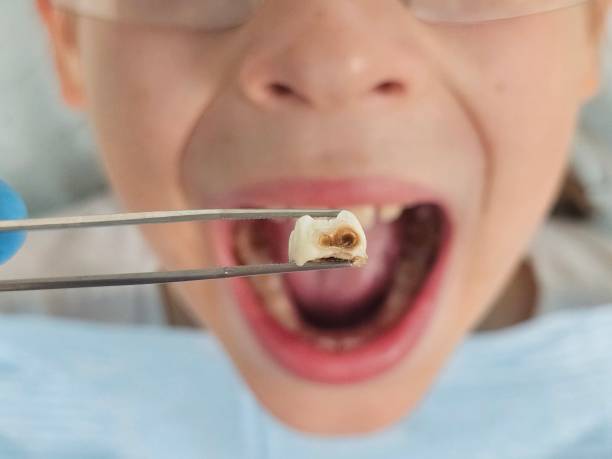 Best Weekend Emergency Dentist in Dixon, KY